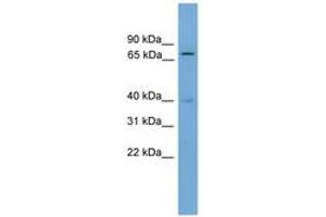 Image no. 1 for anti-Multiple Endocrine Neoplasia 1 (MEN1) (AA 351-400) antibody (ABIN6744537) (Menin 抗体  (AA 351-400))