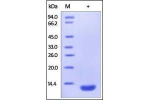 Human beta 2-Microglobulin, His Tag on SDS-PAGE under reducing (R) condition. (beta-2 Microglobulin Protein (AA 21-119) (His tag))