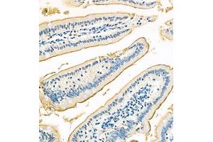 Immunohistochemistry of paraffin embedded mouse jejunum using Treh (ABIN7076006) at dilution of 1:700 (320x lens) (TREH 抗体)