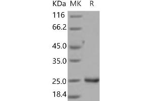 Lipocalin 2 (LCN2) (Active) protein (His tag)