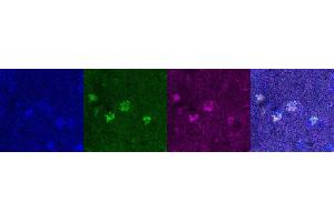 Immunohistochemistry (IHC) image for anti-Oligodendrocyte Lineage Transcription Factor 2 (OLIG2) antibody (ABIN7456327) (OLIG2 抗体)