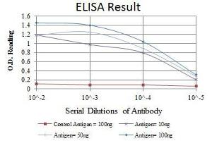 Red: Control Antigen (100 ng), Purple: Antigen (10 ng), Green: Antigen (50 ng), Blue: Antigen (100 ng), (RBP4 抗体)