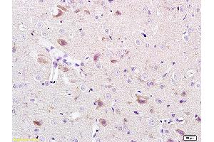 Formalin-fixed and paraffin-embedded rat brain labeled with Anti-CACNA1G/Cav3. (CACNA1G 抗体  (AA 901-1000))
