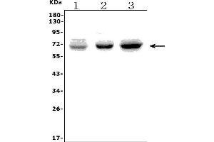 Western blot analysis of PICALM using anti-PICALM antibody (ABIN7599516).