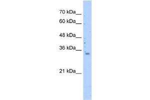 WB Suggested Anti-MRPS15 Antibody Titration: 0. (MRPS15 抗体  (N-Term))