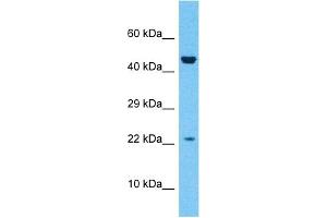 Host:  Rabbit  Target Name:  ZN576  Sample Type:  Fetal Liver lysates  Antibody Dilution:  1ug/ml (ZNF576 抗体  (Middle Region))