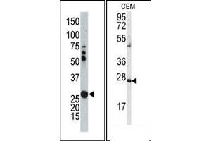 Image no. 1 for anti-Adenylate Kinase 2 (AK2) (N-Term) antibody (ABIN360624) (Adenylate Kinase 2 抗体  (N-Term))