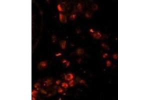 Immunofluorescence (IF) image for anti-Lin-28 Homolog A (C. Elegans) (LIN28A) antibody (ABIN2995304) (LIN28A 抗体)