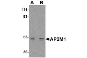 Western blot analysis of AP2M1 in human kidney tissue lysate with AP30054PU-N AP2M1 antibody at (A) 1 and (B) 2 μg/ml. (AP2M1 抗体  (C-Term))
