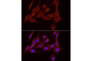 Immunofluorescence analysis of NIH/3T3 cells using SLC7/xCT Rabbit pAb (ABIN6134319, ABIN6148046, ABIN6148047 and ABIN6217771) at dilution of 1:200 (40x lens). (SLC7A11 抗体  (AA 150-250))