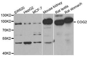 Western blot analysis of extracts of various cell lines, using COG2 antibody. (COG2 抗体  (AA 1-280))