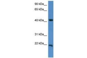 Image no. 1 for anti-Inner Mitochondrial Membrane Peptidase Subunit 2 (IMMP2L) (C-Term) antibody (ABIN6746853) (IMMP2L 抗体  (C-Term))