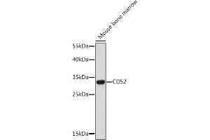 Western blot analysis of extracts of Mouse bone marrow, using CD52 Rabbit pAb (ABIN7266207) at 1:300 dilution. (CD52 抗体  (AA 1-61))
