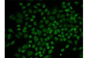 Immunofluorescence analysis of MCF-7 cells using RL2 antibody (ABIN6132938, ABIN6146651, ABIN6146653 and ABIN6217641). (ARIP4 抗体  (AA 1178-1467))