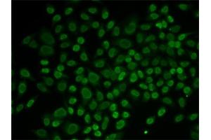 Immunofluorescence analysis of MCF-7 cells using RL2 antibody (ABIN6132938, ABIN6146651, ABIN6146653 and ABIN6217641). (ARIP4 抗体  (AA 1178-1467))