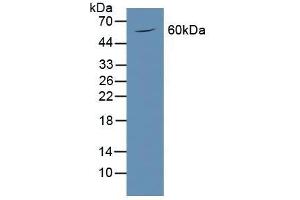 Detection of PODXL in Mouse Brain Tissue using Polyclonal Antibody to Podocalyxin (PODXL) (PODXL 抗体  (AA 220-431))