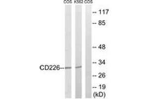 Western blot analysis of extracts from COS7/K562 cells, treated with PMA 125ng/ml 30' , using CD226/DNAM-1 (Ab-329) Antibody. (CD226 抗体  (AA 287-336))