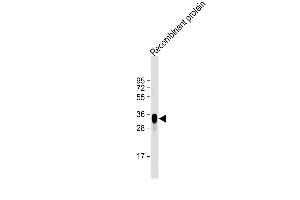 Anti-LRP1B Antibody at 1:2000 dilution + Recombinant protein Lysates/proteins at 20 μg per lane.