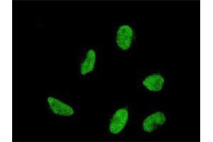 Immunofluorescence of monoclonal antibody to HOXA5 on HeLa cell. (HOXA5 抗体  (AA 171-270))