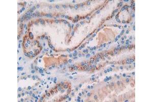 Used in DAB staining on fromalin fixed paraffin- embedded kidney tissue (COL18A1 抗体  (AA 1154-1335))