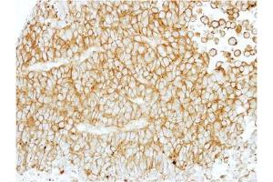 Immunohistochemistry (Paraffin-embedded Sections) (IHC (p)) image for anti-Egf-Like Module Containing, Mucin-Like, Hormone Receptor-Like 1 (EMR1) (AA 626-886) antibody (ABIN784004)