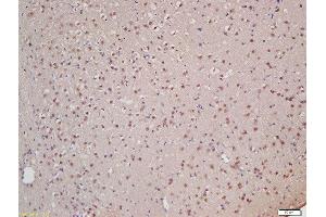 Formalin-fixed and paraffin embedded rat brain labeled with Rabbit Anti-XPB Polyclonal Antibody, Unconjugated (ABIN706031) at 1:200 followed by conjugation to the secondary antibody and DAB staining (ERCC3 抗体  (AA 601-700))