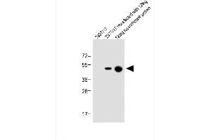 All lanes : Anti-His Tag Antibody at 1:1000 dilution Lane 1: 293T/17 whole cell lysate Lane 2: 293T/17 transfected with 12tag whole cell lysate Lane 3: 12tag recombinant protein Lysates/proteins at 1 μg per lane. (His Tag 抗体)