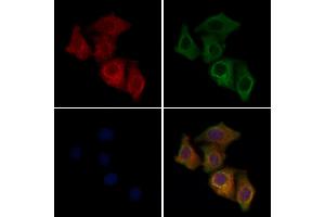 ABIN6258638 and ABIN6275572 staining Hela cells by IF/ICC.