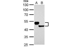 WB Image Cytokeratin 13 antibody detects KRT13 protein by Western blot analysis. (Cytokeratin 13 抗体)