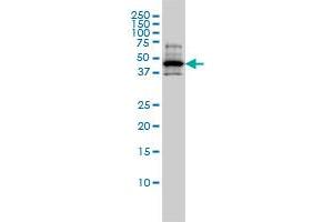 RCC1 monoclonal antibody (M01), clone 2F1 Western Blot analysis of RCC1 expression in A-431 . (RCC1 抗体  (AA 312-421))