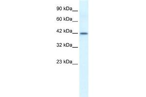 WB Suggested Anti-ESR2 Antibody Titration: 0. (ESR2 抗体  (N-Term))