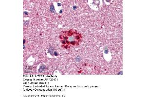 Immunohistochemistry with Human Brain, cortex, senile plaque tissue at an antibody concentration of 5. (TCF21 抗体  (N-Term))