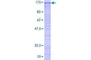 SF3B2 Protein (AA 1-636) (GST tag)