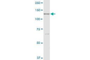 RECK MaxPab rabbit polyclonal antibody. (RECK 抗体  (AA 1-971))