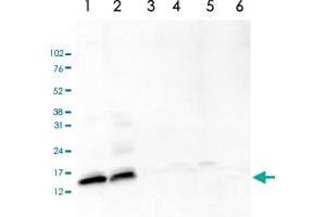 Western Blot analysis of (1) 25 ug whole cell extracts of Hela cells, (2) 15 ug histone extracts of Hela cells, (3) 1 ug of recombinant histone H2A, (4) 1 ug of recombinant histone H2B, (5) 1 ug of recombinant histone H3, (6) 1 ug of recombinant histone H4. (HIST3H2A 抗体  (acLys5))