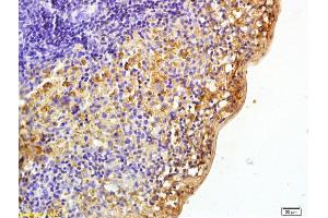 Formalin-fixed and paraffin embedded rat spleen labeled with Rabbit Anti phospho-Pyk2/PTK2B(Tyr402) Polyclonal Antibody, Unconjugated (ABIN745763) at 1:200 followed by conjugation to the secondary antibody and DAB staining (PTK2B 抗体  (pTyr402))