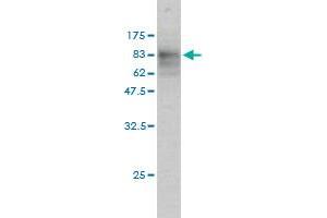 Western Blot detection against Immunogen (74. (SQSTM1 抗体  (AA 1-440))