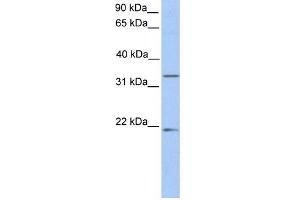 FUT6 antibody used at 1 ug/ml to detect target protein. (FUT6 抗体  (C-Term))