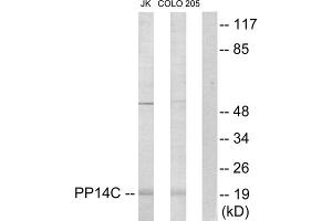 Western blot analysis of extracts from Jurkat cells and COLO205 cells, using PP14C antibody. (PPP1R14C 抗体  (Internal Region))