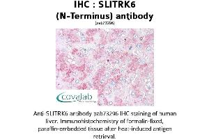 Image no. 1 for anti-SLIT and NTRK-Like Family, Member 6 (SLITRK6) (N-Term) antibody (ABIN1739443) (SLITRK6 抗体  (N-Term))
