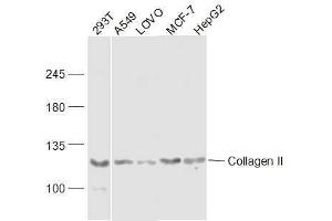 Western Blotting (WB) image for anti-Collagen, Type II, alpha 1 (COL2A1) (AA 231-330) antibody (ABIN2559415)