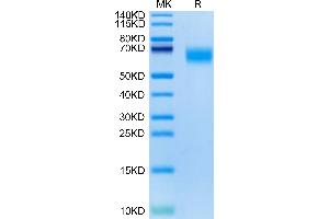 SDS-PAGE (SDS) image for Colony Stimulating Factor 2 Receptor, Alpha, Low-Affinity (Granulocyte-Macrophage) (CSF2RA) (AA 20-317) protein (His tag) (ABIN7274779)
