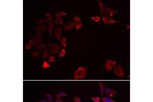 Immunofluorescence analysis of HeLa cells using SKAP2 Polyclonal Antibody (SKAP2 抗体)