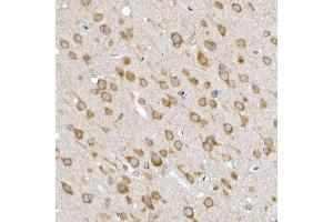 Immunohistochemistry (IHC) image for anti-Signal Recognition Particle 72kDa (SRP72) antibody (ABIN6134166)