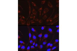 Immunofluorescence analysis of RD cells using CRAT Rabbit pAb (ABIN6131297, ABIN6139003, ABIN6139004 and ABIN6221982) at dilution of 1:50 (40x lens). (CRAT 抗体  (AA 357-626))