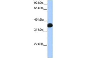 Western Blotting (WB) image for anti-Lactate Dehydrogenase B (LDHB) antibody (ABIN2463156) (LDHB 抗体)