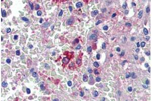 Spleen, Human: Formalin-Fixed, Paraffin-Embedded (FFPE) (HMOX1 抗体)