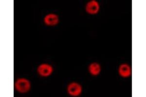 ABIN6274012 staining HepG2 by IF/ICC. (GATA2 抗体)