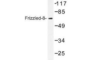 Image no. 1 for anti-Frizzled Family Receptor 8 (FZD8) antibody (ABIN317702) (FZD8 抗体)