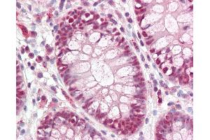 Immunohistochemistry (IHC) image for anti-Caudal Type Homeobox 2 (CDX2) (AA 1-60) antibody (ABIN1100745)